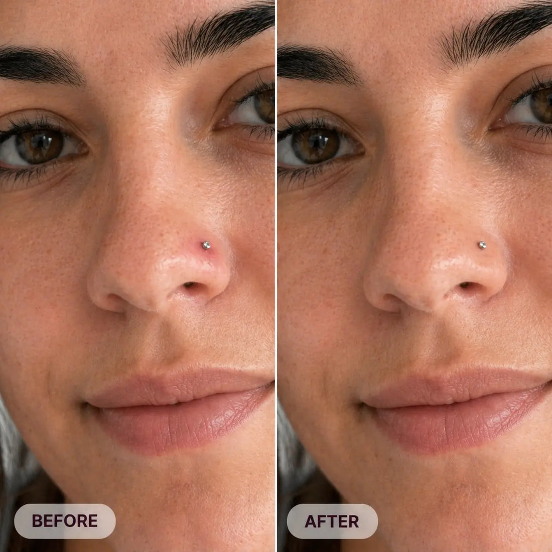 The Piercing Bump Story I Wish I Had Read Before Panicking Satori Cosmetics
