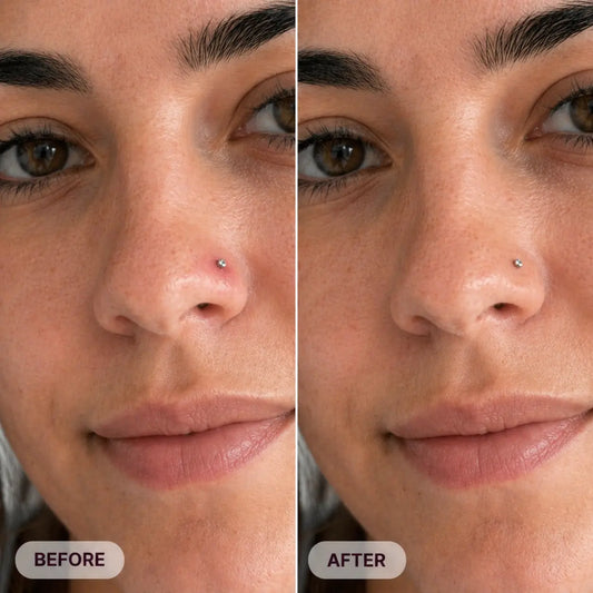 The Piercing Bump Story I Wish I Had Read Before Panicking Satori Cosmetics