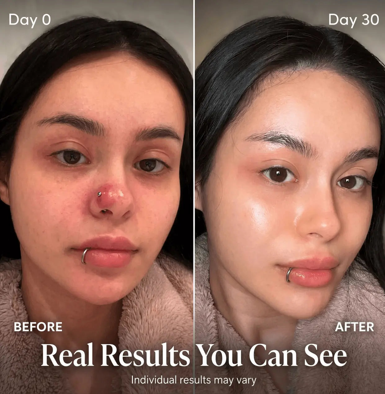 Critical Care Piercing Bump & Scar Reducer Satori Cosmetics
