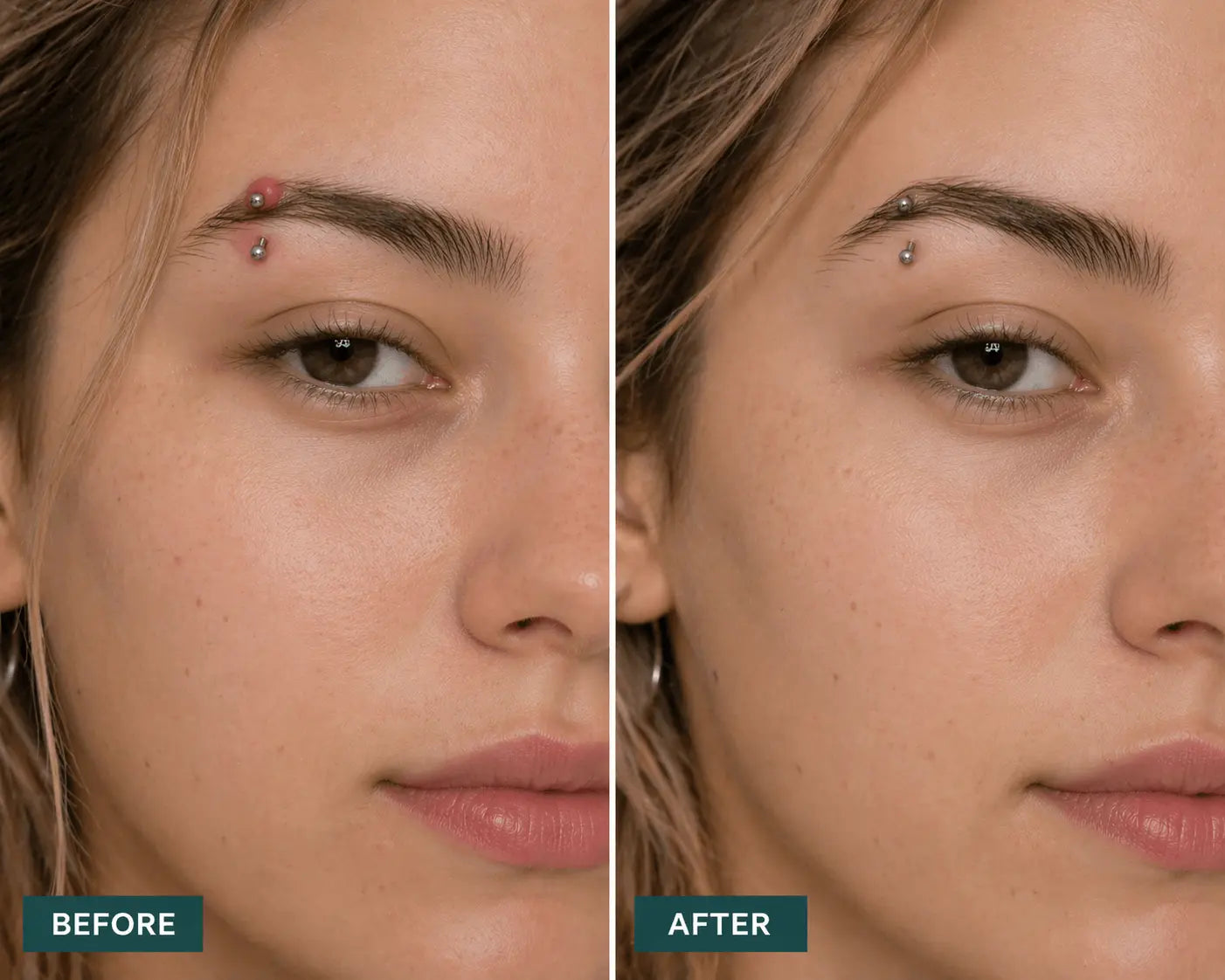 Critical Care Piercing Bump & Scar Reducer Satori Cosmetics