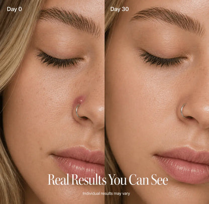 Critical Care Piercing Bump & Scar Reducer Satori Cosmetics